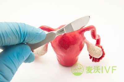 查血HCG能查出宫外孕吗？