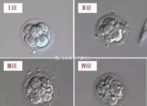 胚胎也分三六九等 你的胚胎能得几分?