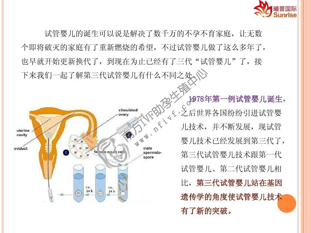试管婴儿_1
