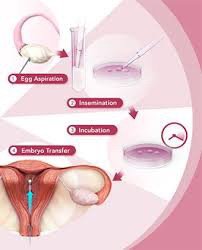 第三代试管婴儿_1