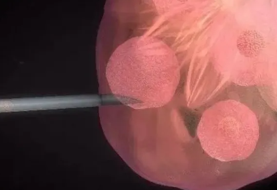 9c29b202212161355446642.png 9c29b202212161355446642.png